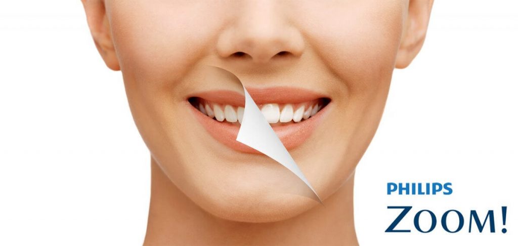بالزوم تبييض الاسنان كيف يتم