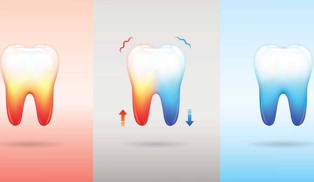 اسباب حساسية الاسنان وخطوات علاجها الاولى ، رعاية كوم الاسنان